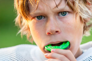 Dental Mouth Guards